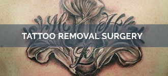 Laser Tattoo Removal Cost|Q-switch Laser (Delhi) - Care Well Medical Center  the Cosmetic Center