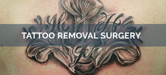 Laser Tattoo Removal Cost|Q-switch Laser (Delhi) - Care Well Medical Center the Cosmetic Center Laser Tattoo Removal Cost|Q-switch Laser (Delhi) - Care Well Medical Center the Cosmetic Center